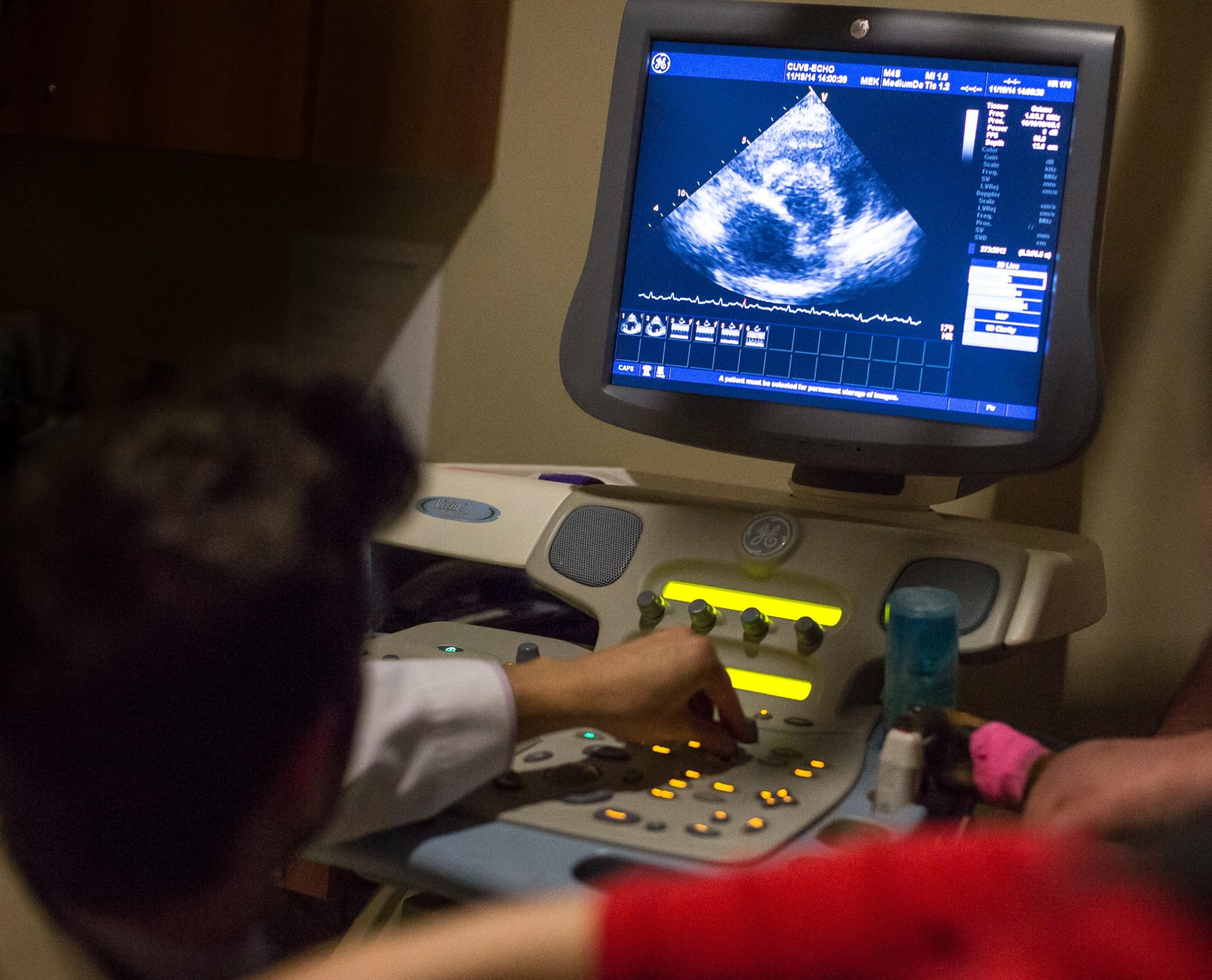 Echocardiography